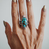 Kingman Turquoise Ring (Size 7.75)