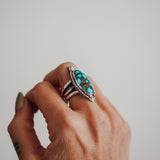 Kingman Turquoise Ring (Size 7.75)